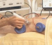 Electrotherapy treatment